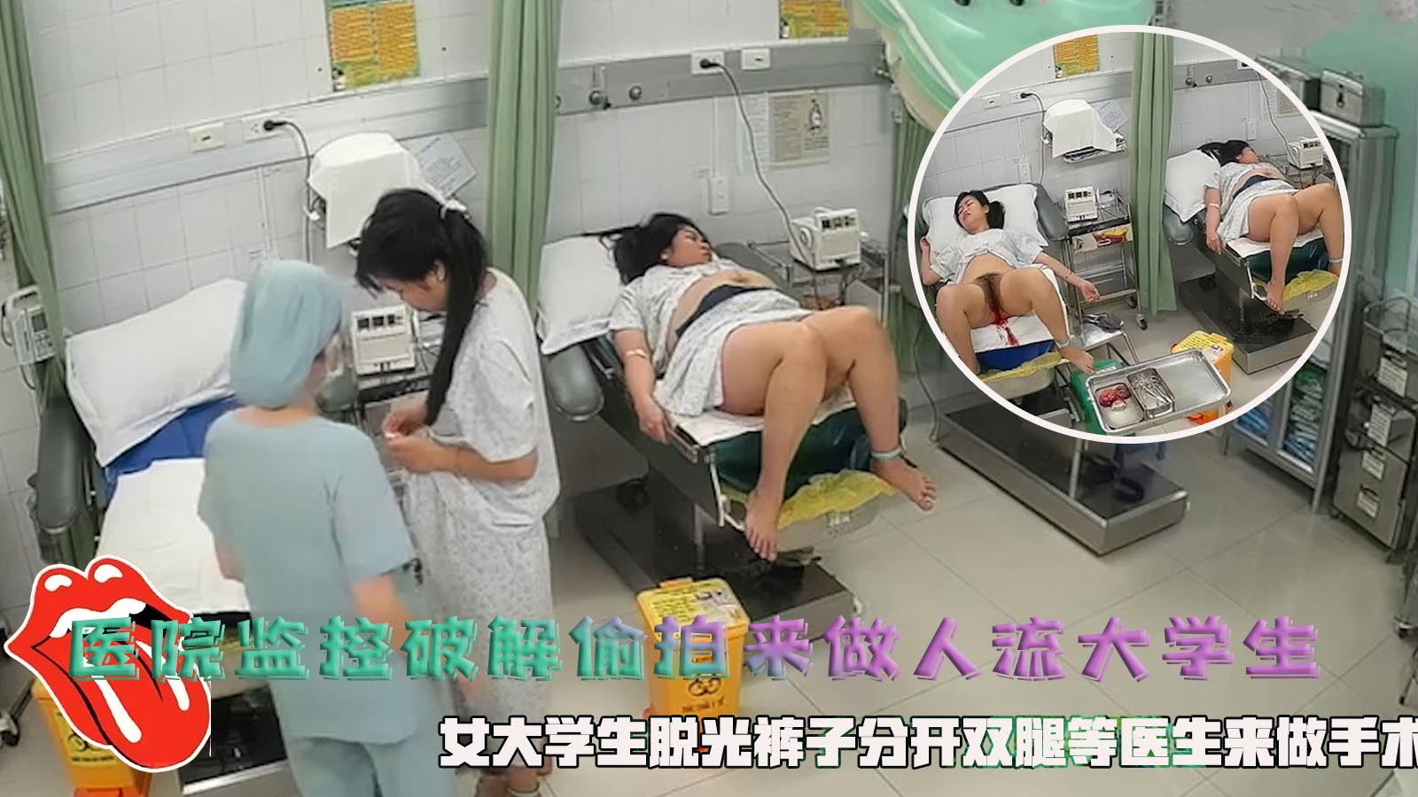 医院监控破解偷拍来做人流大学生，女大学生脱光裤子分开双腿等医生来做手术。}