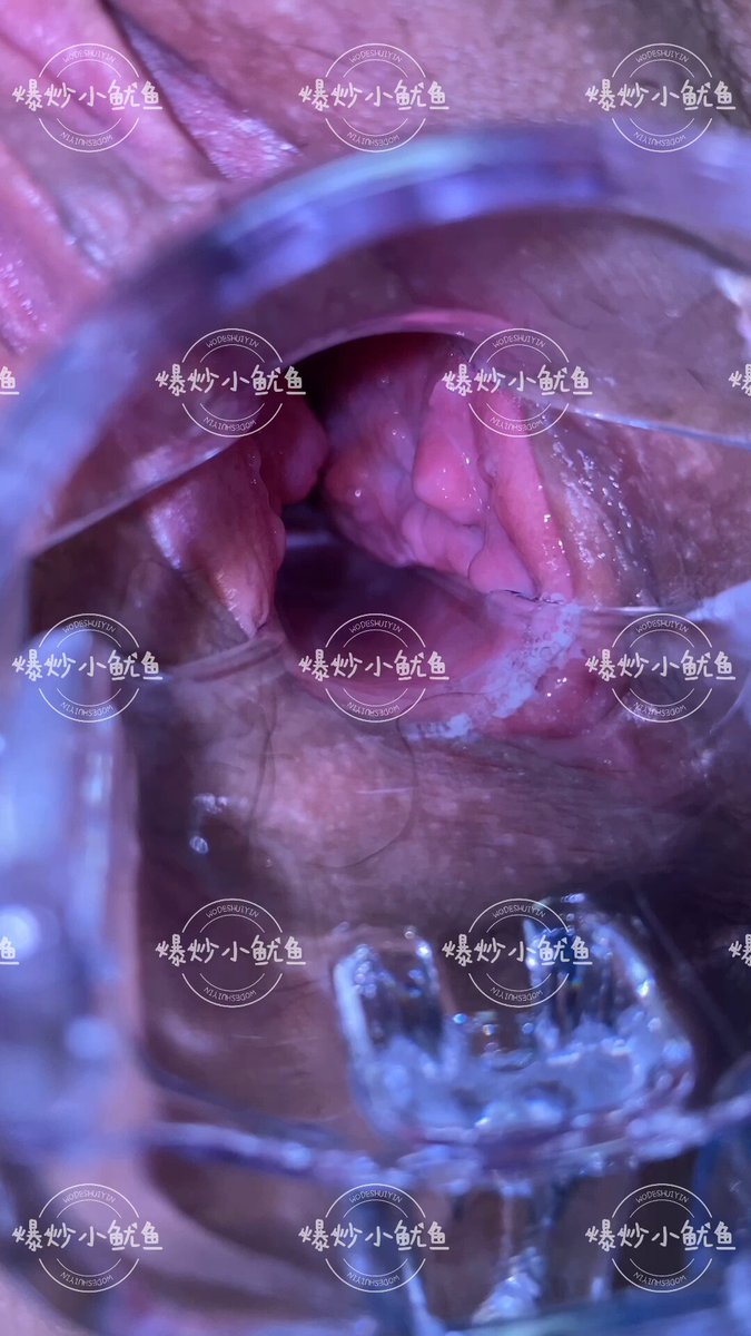 或许应该叫做扩阴}